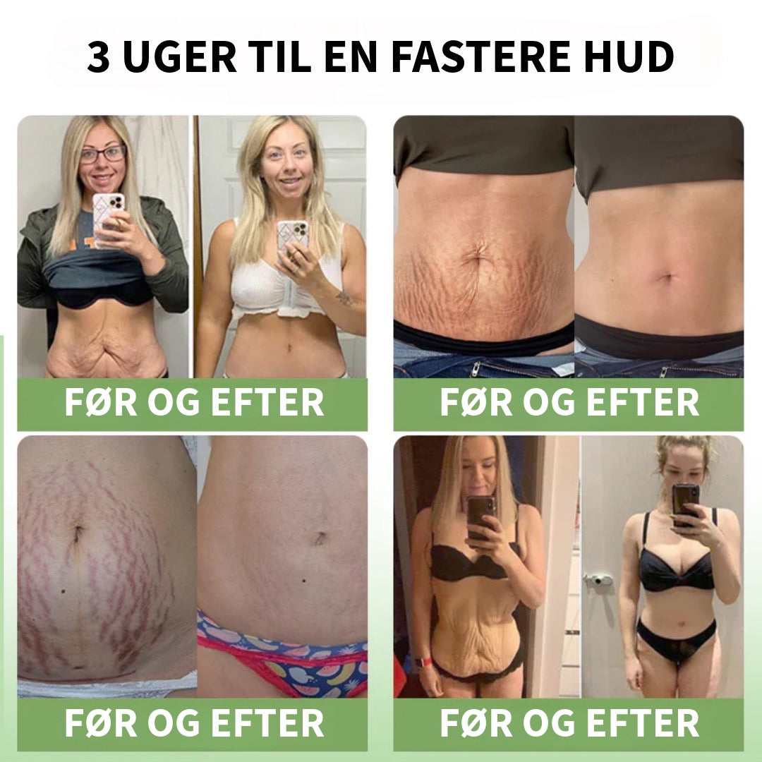 Kollagencreme